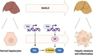 Promoter demethylation and protein O-GlcNAcylation-mediated enhancement of fatty acid synthase contributes to hepatic steatosis and inflammation in MASLD